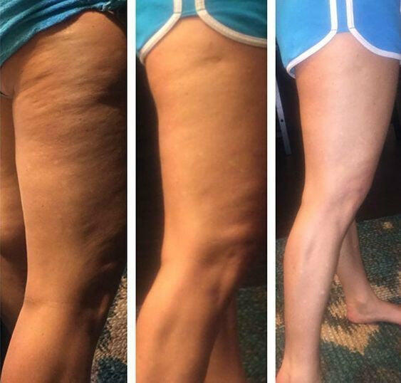 Image #1 from Barbara V.