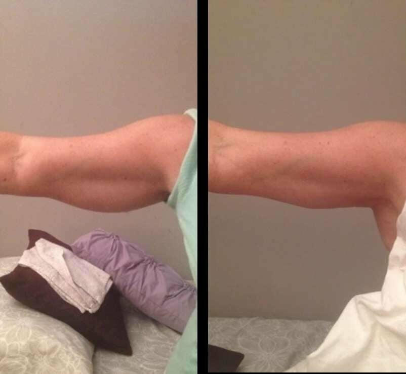 Image #1 from Patricia U.